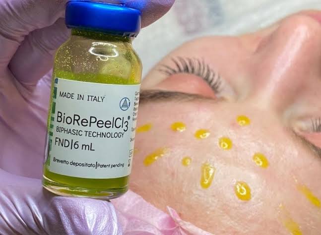 Experience a relaxing and rejuvenating process as you go through the Biorepeel treatment