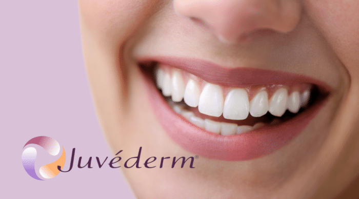 Introducing Juvederm Smile