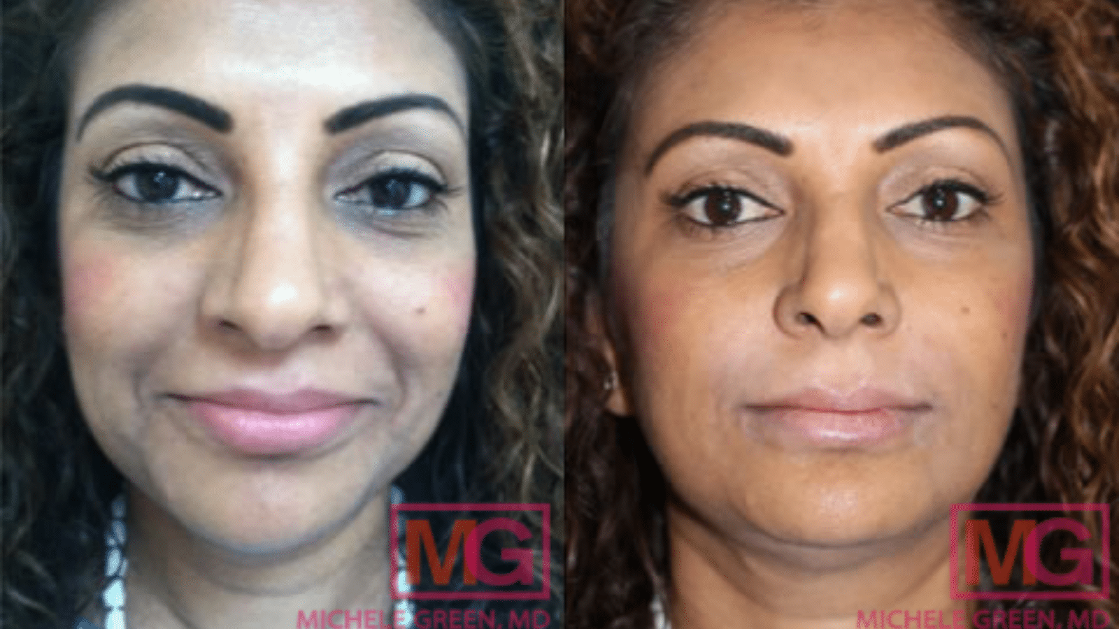 Before and after pictures.