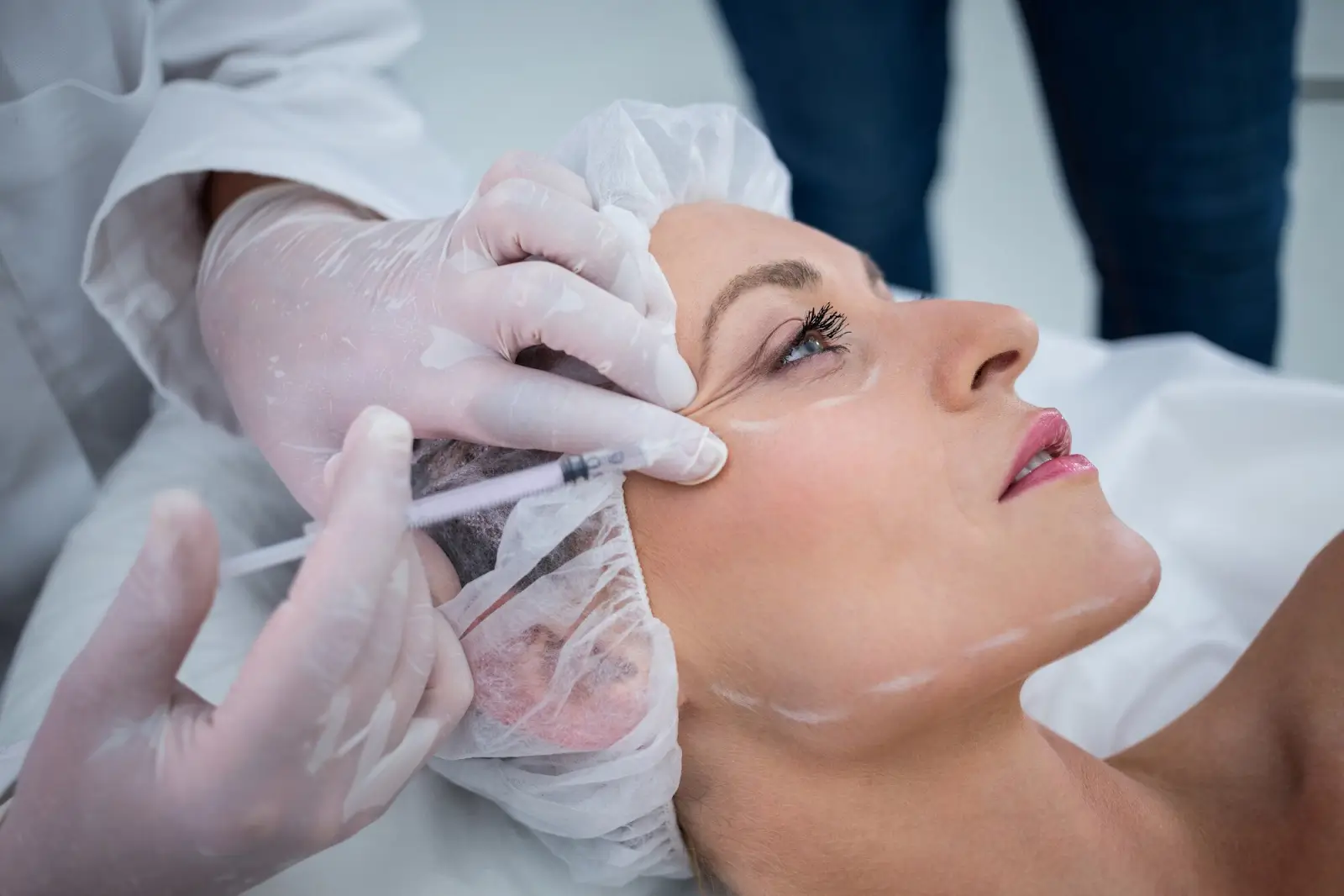 A person receiving an injection near their eye while lying down. They wear a hair net, and a gloved professional administers the injection. White markings are visible on the person's face, possibly for procedural guidance.