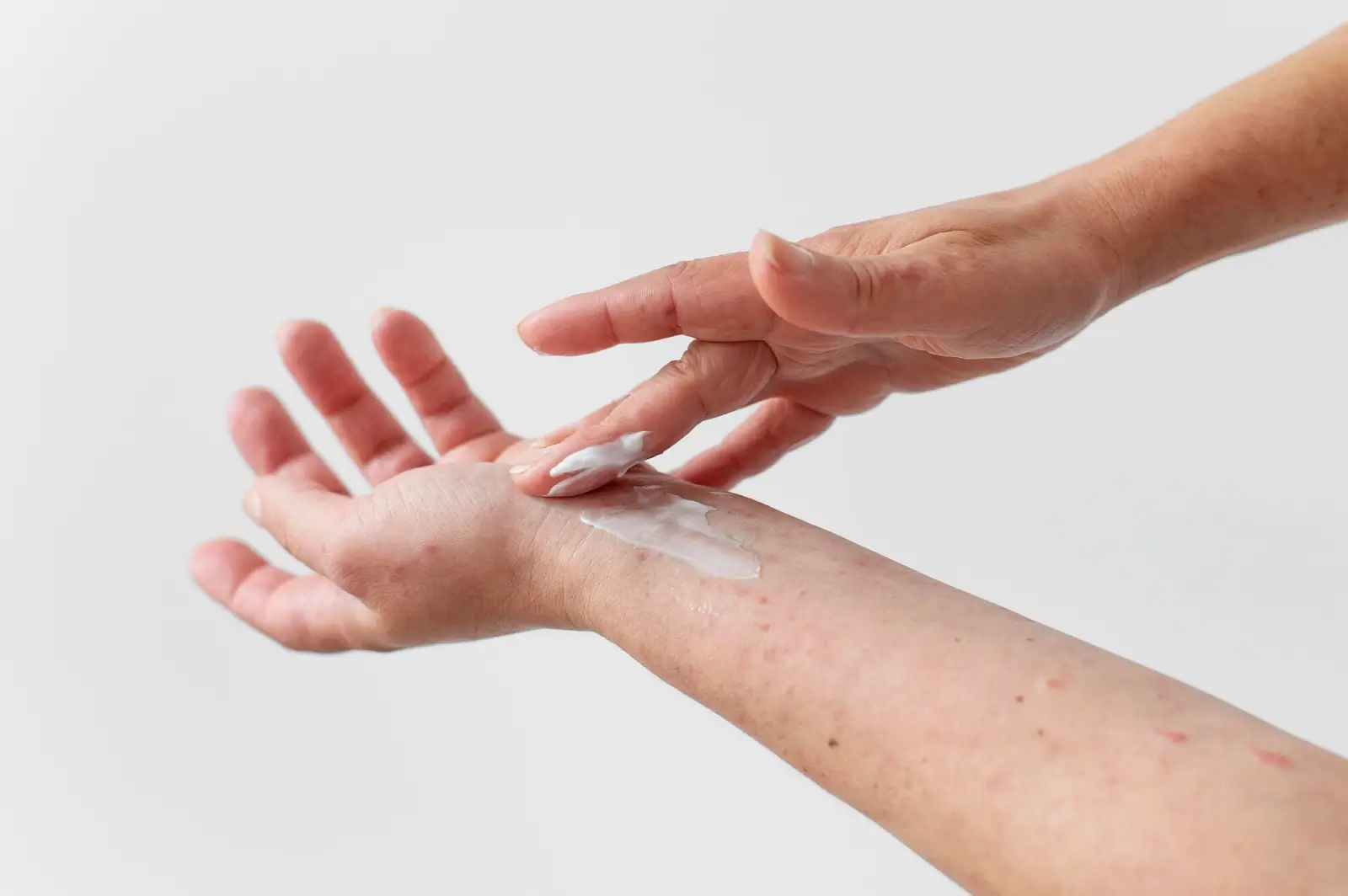 A person is applying a dollop of lotion to their forearm with their fingers. The background is plain and white, emphasizing the close-up of the hands and forearm. The skin appears to have a few red spots.
