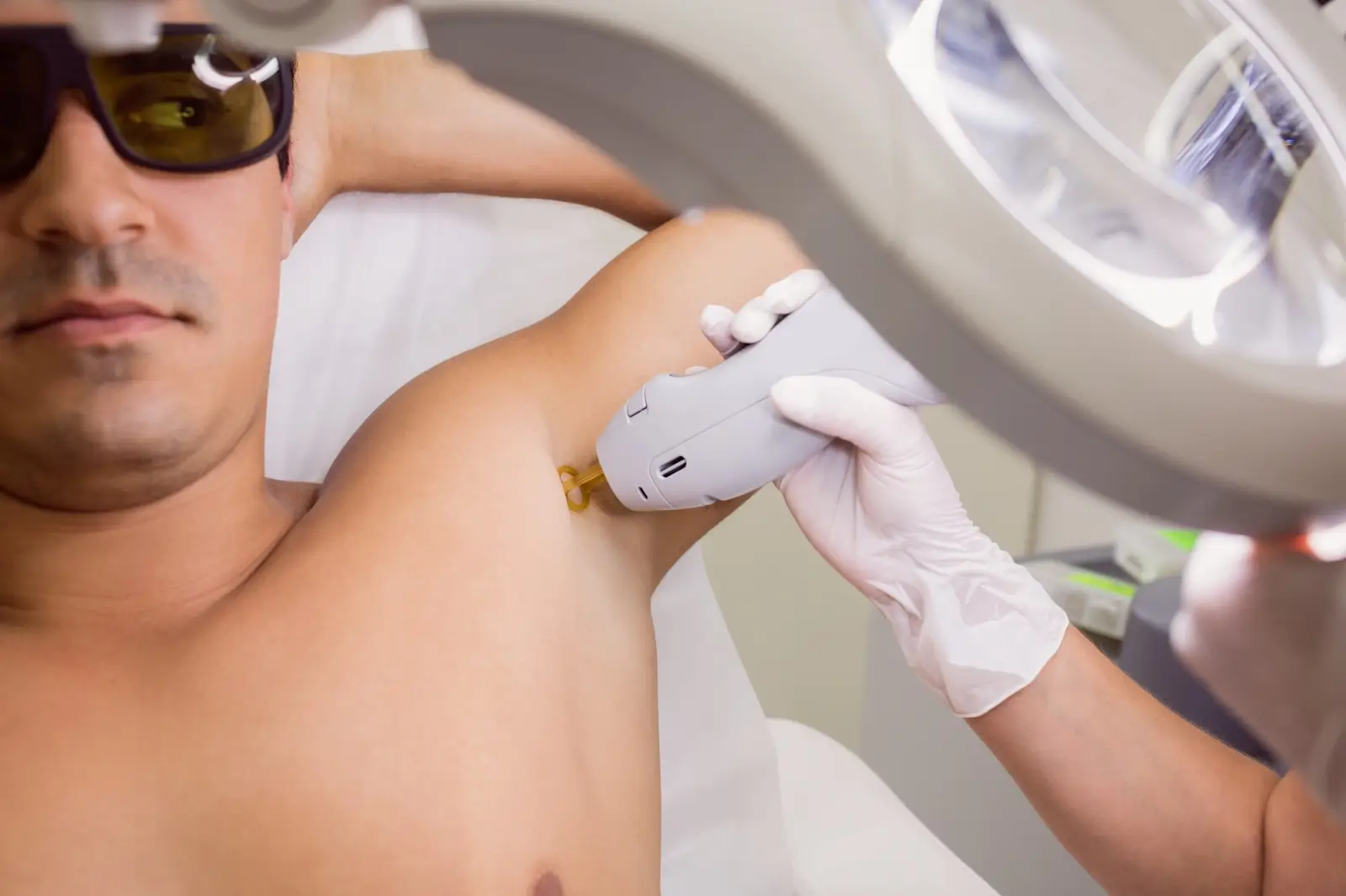 A person lying down wearing protective glasses receives laser hair removal treatment on their armpit. A technician in gloves holds the laser device under a magnifying lamp.
