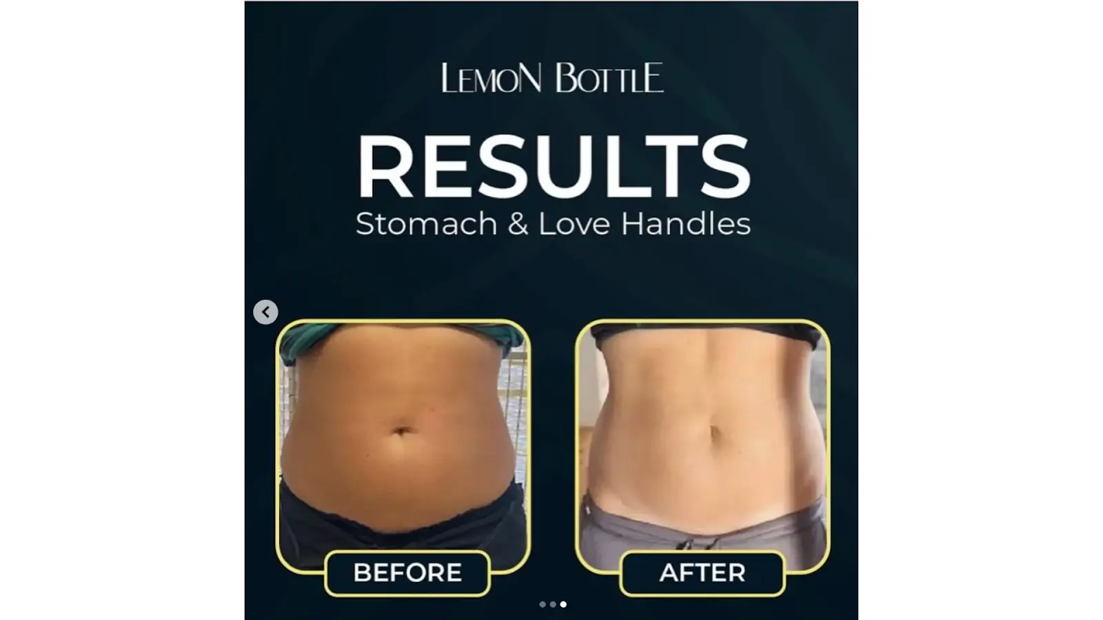Side-by-side comparison of a person's midsection labeled "Before" and "After," showing reduced stomach and love handles. The text reads: "Lemon Bottle Results: Stomach & Love Handles.