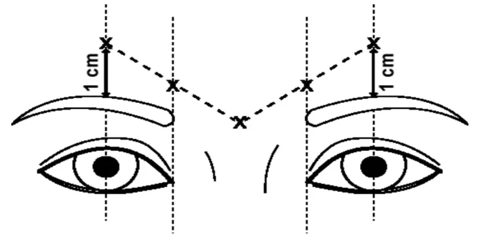 Dysport brow lift injection points: Line drawing of two eyes and eyebrows with dashed lines connecting points above each brow, each marked 1 cm above the brow's start, indicating eyebrow positioning or measurement.