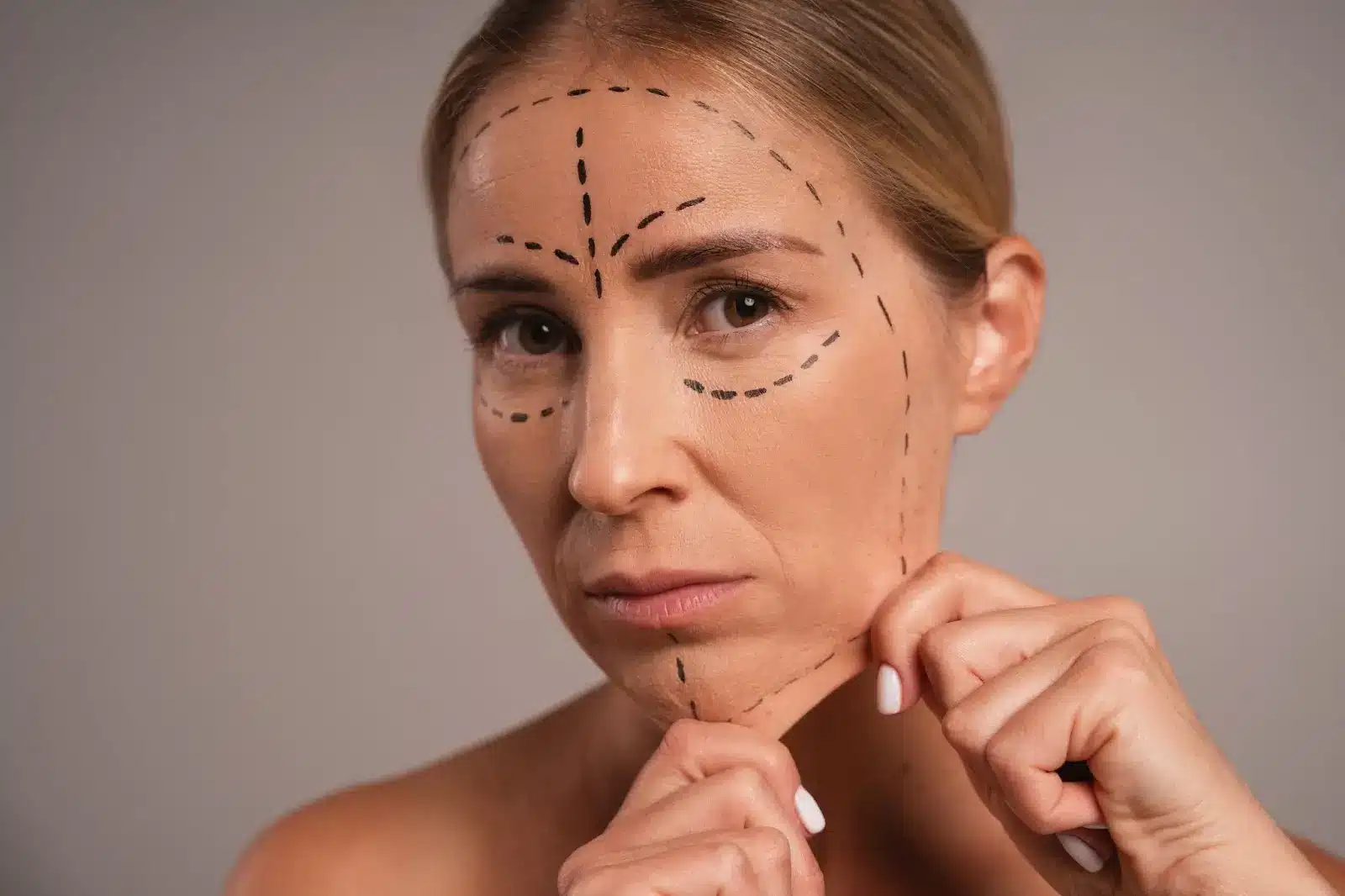 A woman with light skin and blonde hair pulls at the skin on her chin. Her face shows black surgical marker lines, indicating areas for possible cosmetic procedures. The background is neutral and plain.