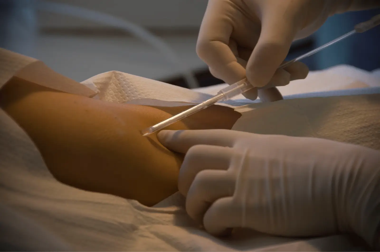 A medical professional wearing gloves inserts a medical device inside the patient's skin, while the patient’s arm rests on a sterile pad.