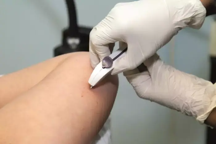 A gloved hand uses a small medical device to inject or draw fluid from a person's arm, suggesting a medical procedure or vaccination.