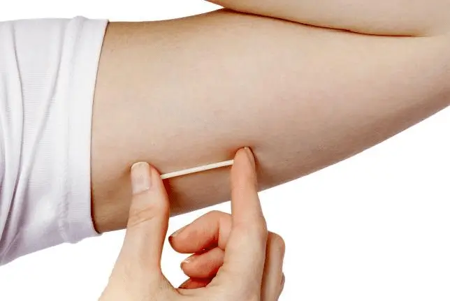 A hand holds a small contraceptive implant (like Nexplanon) against their inner upper arm, possibly showing where the implant can be inserted.