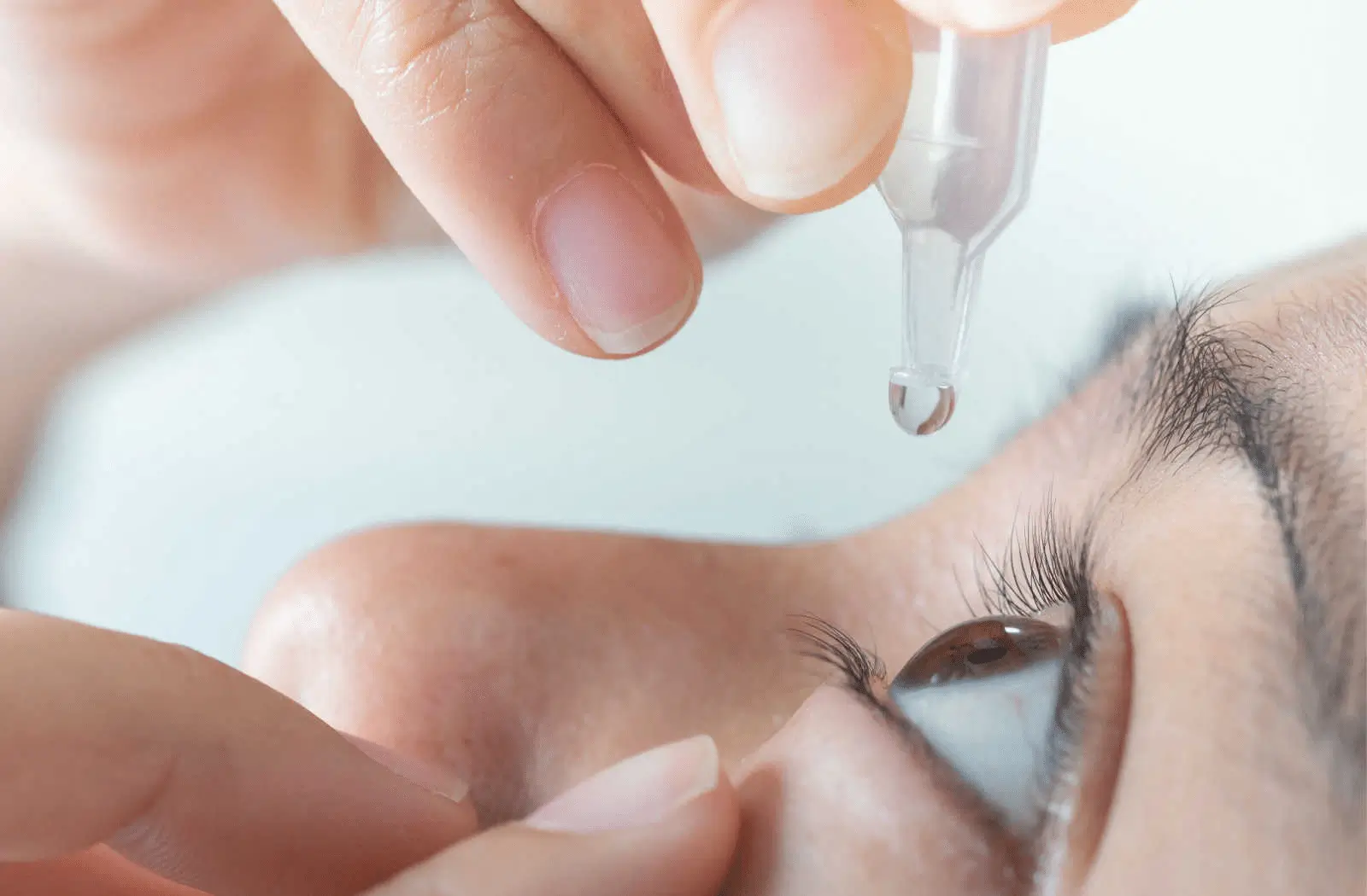 A close-up of a person’s face as they use their fingers to hold open an eye while applying eye drops from a plastic dropper.