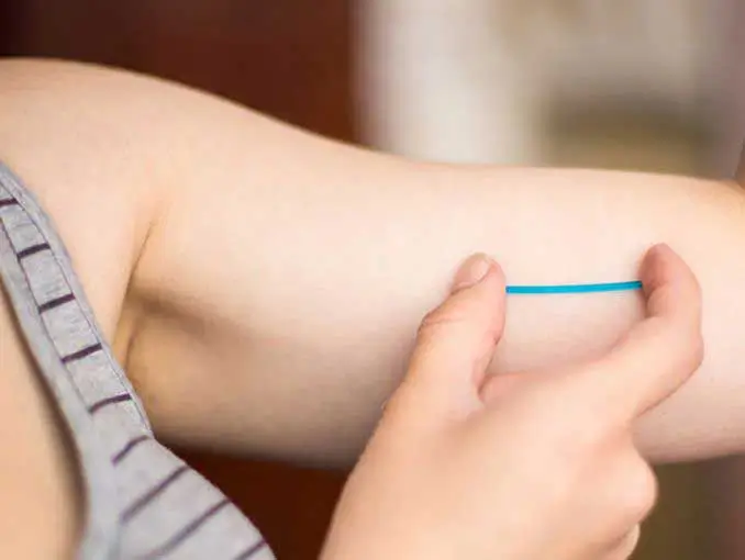 A person holds their arm out while using their fingers to touch a small, thin contraceptive implant just under the skin of their upper arm.